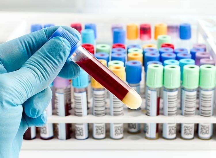 COVID-19 PCR Test