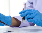 The Importance of Timely and Accurate Lab Results in Healthcare: A Deep Dive Into AHD's Commiment